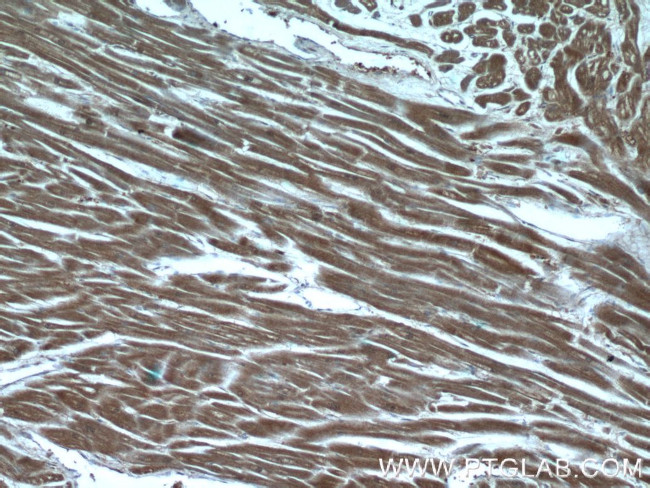 PGP Antibody in Immunohistochemistry (Paraffin) (IHC (P))