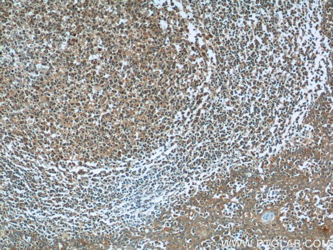 PGP Antibody in Immunohistochemistry (Paraffin) (IHC (P))