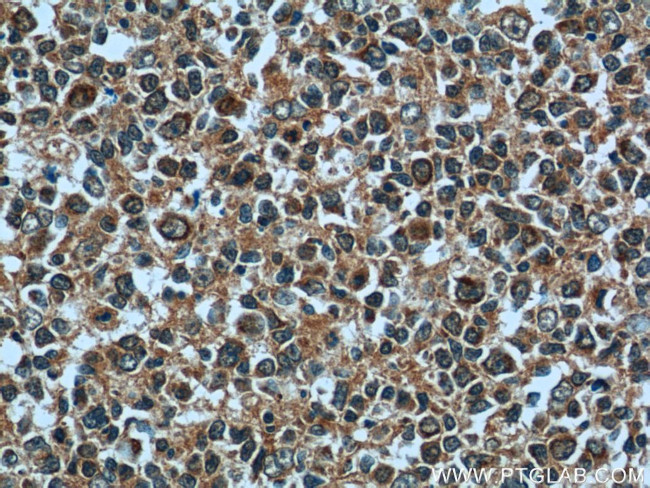 PGP Antibody in Immunohistochemistry (Paraffin) (IHC (P))