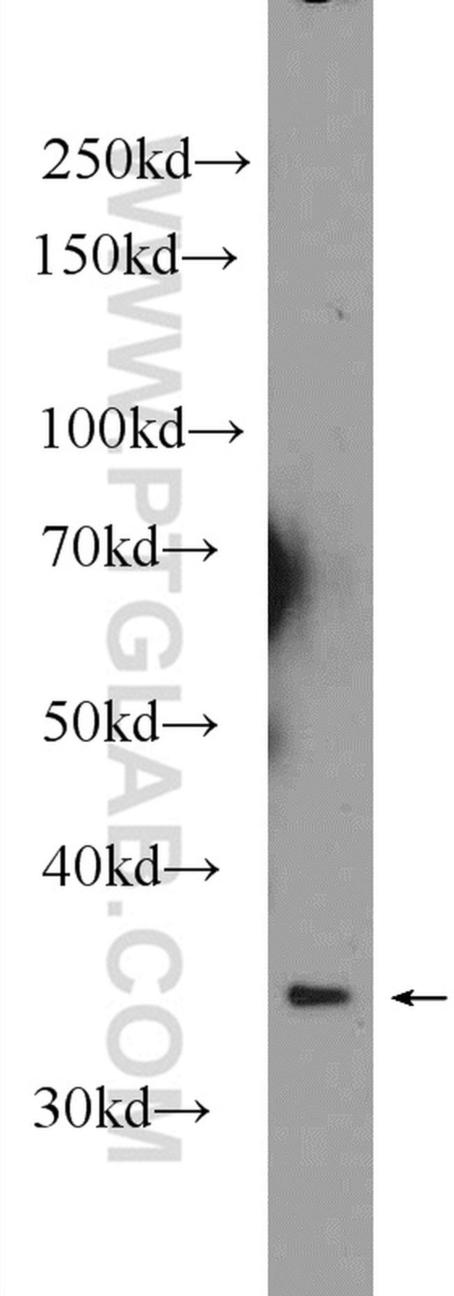 PGP Antibody in Western Blot (WB)