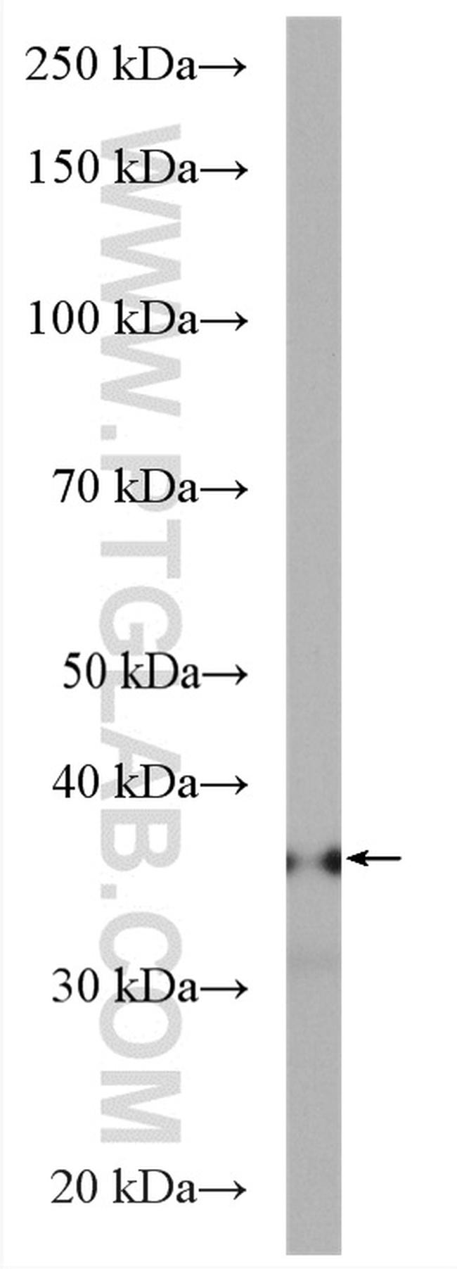 PGP Antibody in Western Blot (WB)