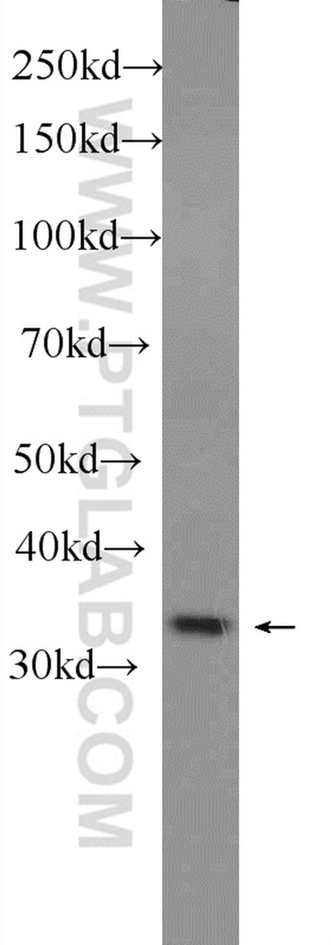 PGP Antibody in Western Blot (WB)