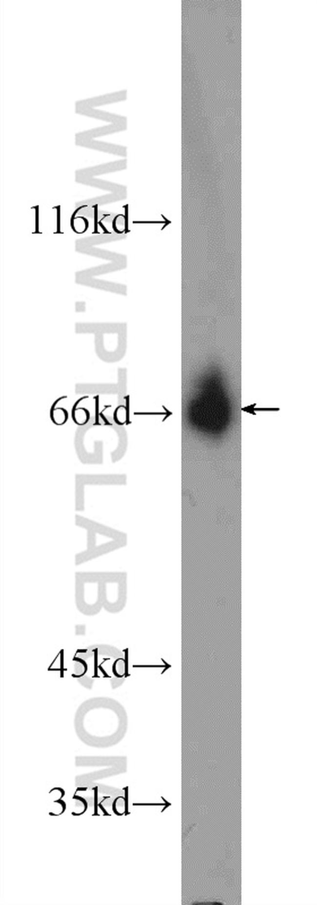 TTC26 Antibody in Western Blot (WB)