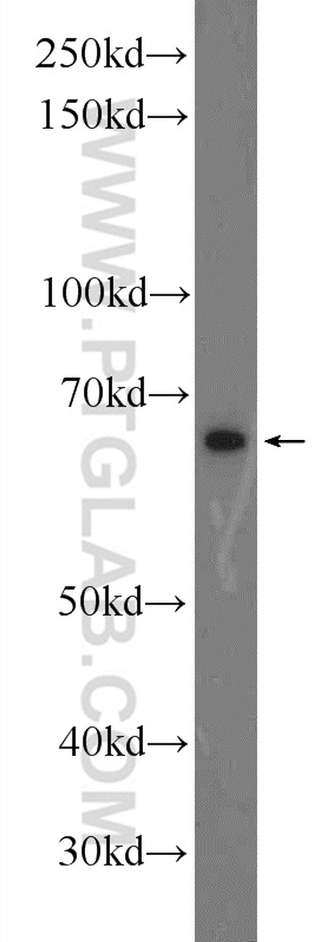 TTC26 Antibody in Western Blot (WB)