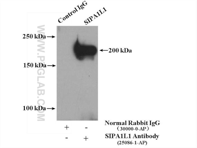 SIPA1L1 Antibody in Immunoprecipitation (IP)