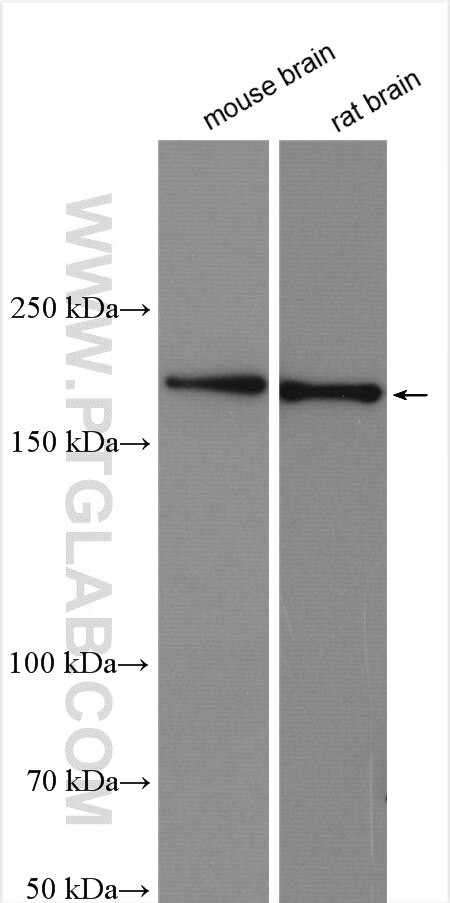 SIPA1L1 Antibody in Western Blot (WB)