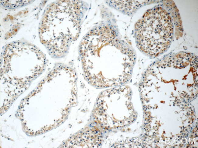 ODF3 Antibody in Immunohistochemistry (Paraffin) (IHC (P))