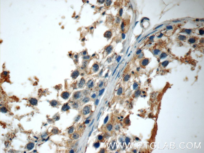 ODF3 Antibody in Immunohistochemistry (Paraffin) (IHC (P))