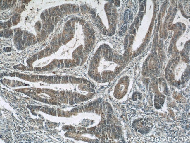 JMY Antibody in Immunohistochemistry (Paraffin) (IHC (P))