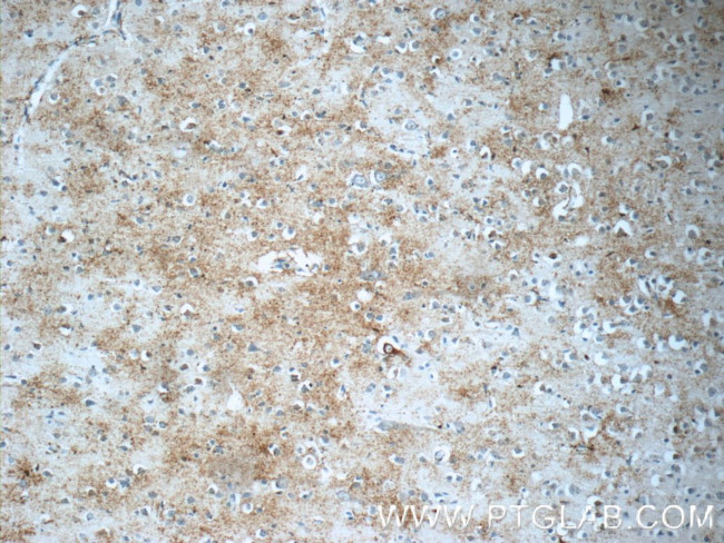 JMY Antibody in Immunohistochemistry (Paraffin) (IHC (P))