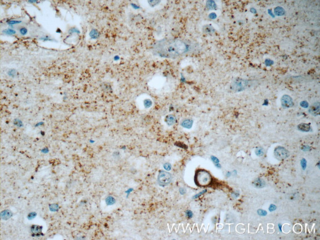 JMY Antibody in Immunohistochemistry (Paraffin) (IHC (P))