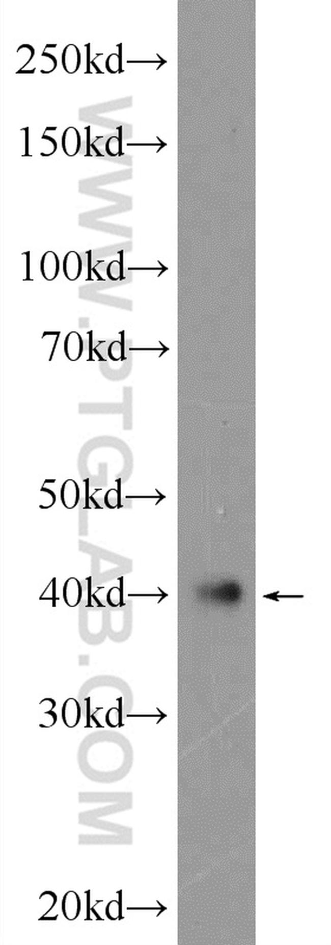 ATXN3L Antibody in Western Blot (WB)