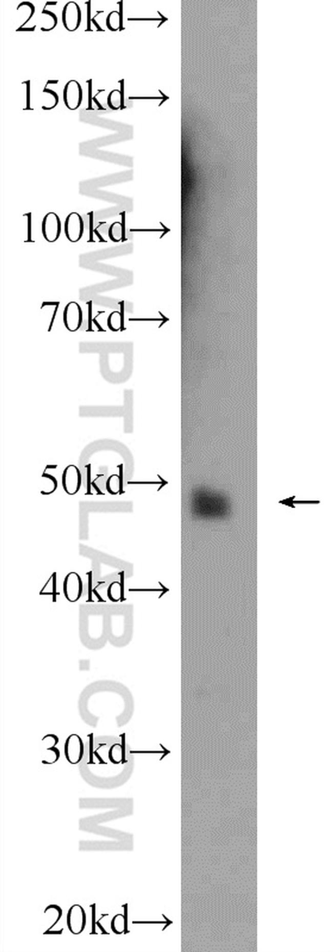 ATXN3L Antibody in Western Blot (WB)