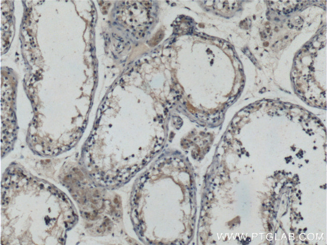 HIPK3 Antibody in Immunohistochemistry (Paraffin) (IHC (P))