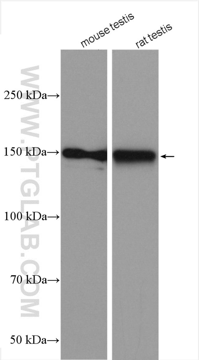 HIPK3 Antibody in Western Blot (WB)