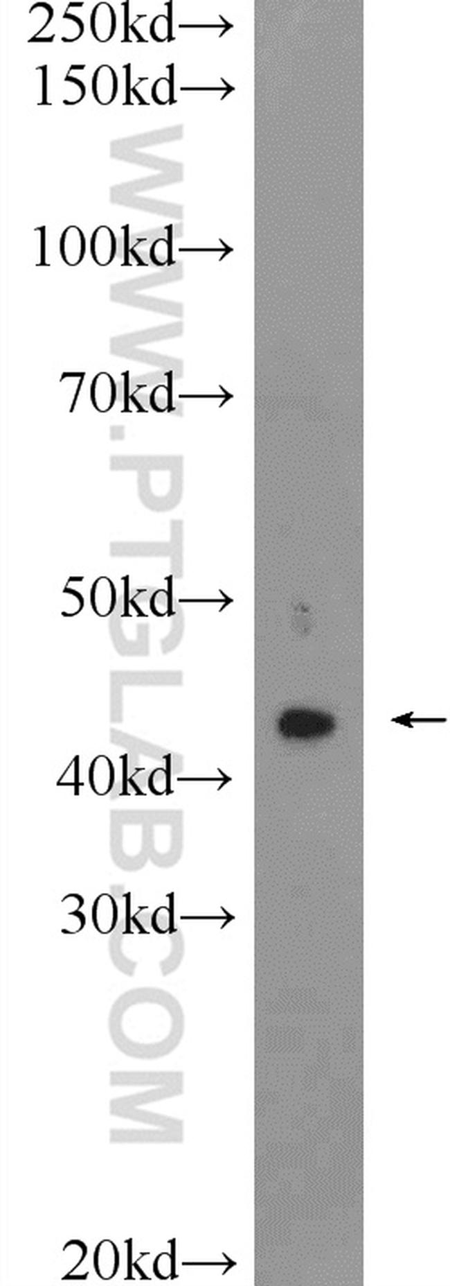 AWAT2 Antibody in Western Blot (WB)