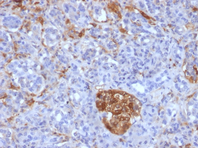 Ferritin, Light Chain Antibody in Immunohistochemistry (Paraffin) (IHC (P))