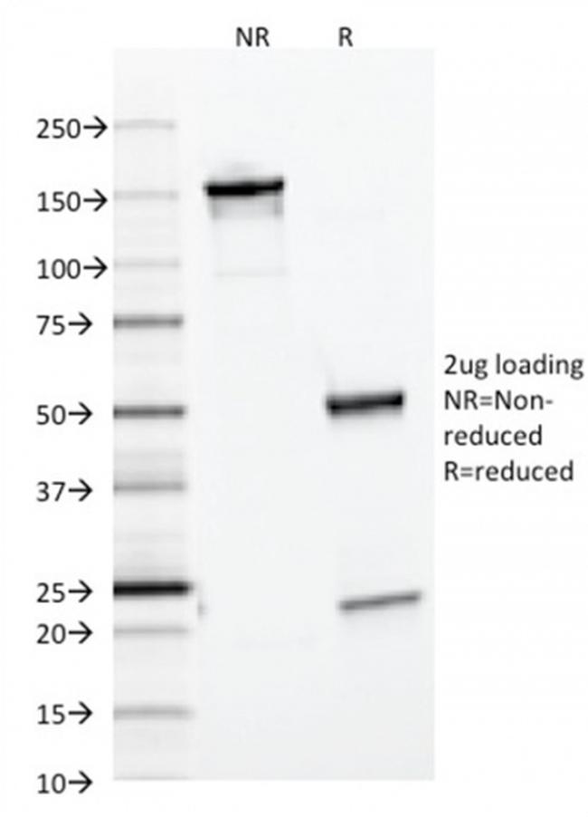 Ferritin, Light Chain Antibody in SDS-PAGE (SDS-PAGE)