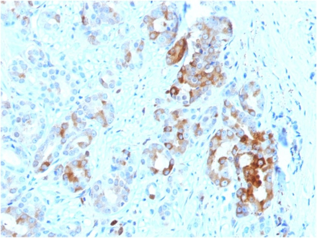 Ferritin, Light Chain (Node-Negative Breast Tumor Prognostic Marker) Antibody in Immunohistochemistry (Paraffin) (IHC (P))