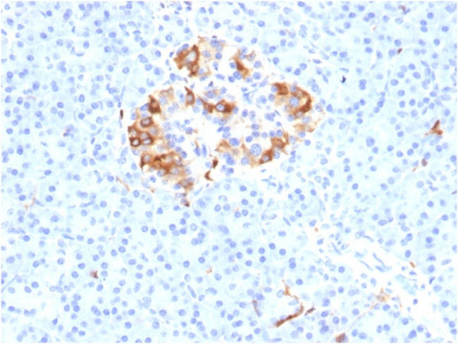 Ferritin, Light Chain (Node-Negative Breast Tumor Prognostic Marker) Antibody in Immunohistochemistry (Paraffin) (IHC (P))