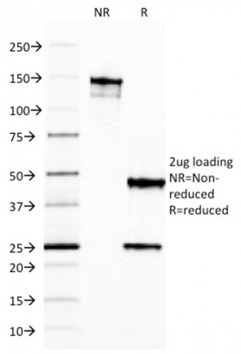 Ferritin, Light Chain (Node-Negative Breast Tumor Prognostic Marker) Antibody in SDS-PAGE (SDS-PAGE)