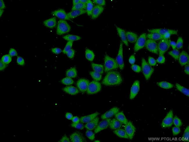 TPTE2 Antibody in Immunocytochemistry (ICC/IF)