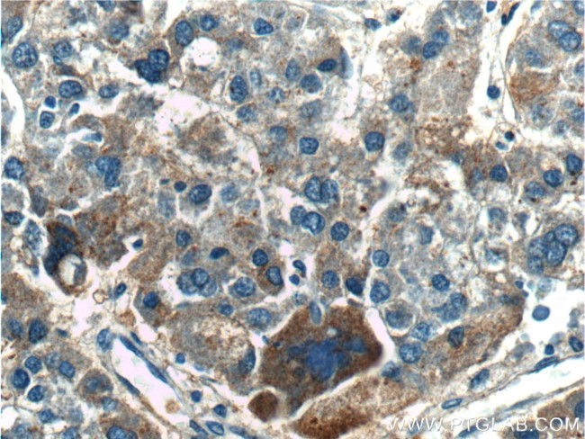 TPTE2 Antibody in Immunohistochemistry (Paraffin) (IHC (P))