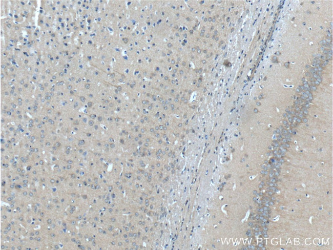 HAP1 Antibody in Immunohistochemistry (Paraffin) (IHC (P))