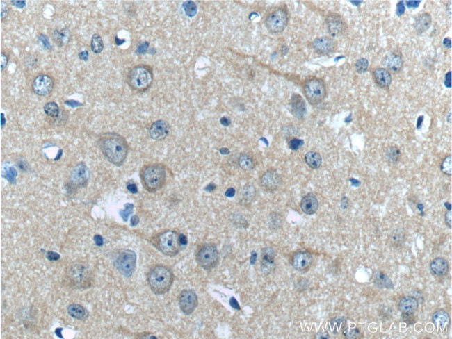 HAP1 Antibody in Immunohistochemistry (Paraffin) (IHC (P))