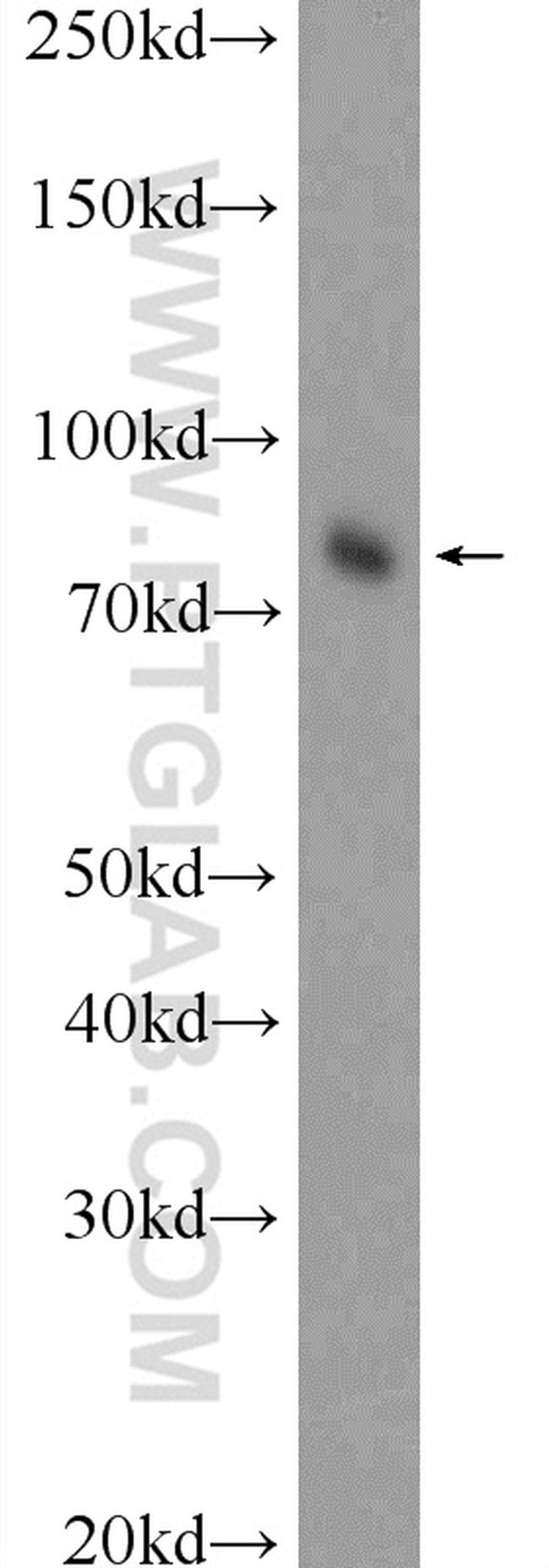 HAP1 Antibody in Western Blot (WB)