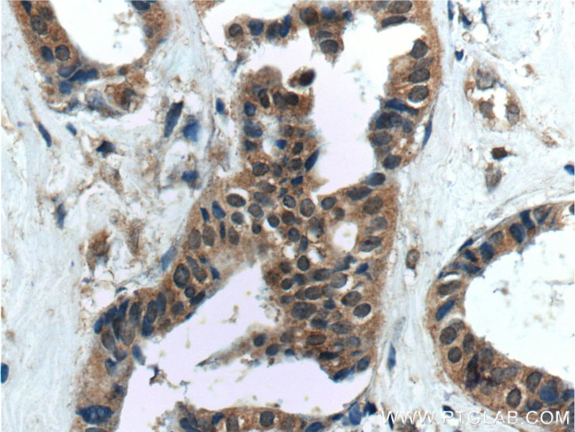 WDFY3 / ALFY Antibody in Immunohistochemistry (Paraffin) (IHC (P))