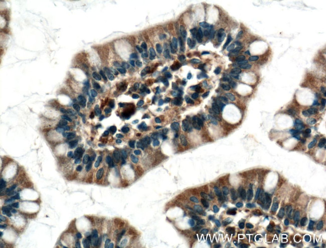 DAPK1 Antibody in Immunohistochemistry (Paraffin) (IHC (P))