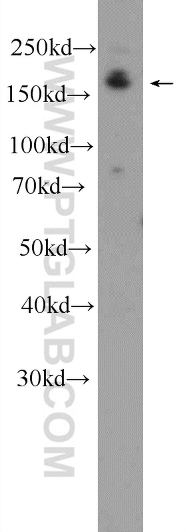 DAPK1 Antibody in Western Blot (WB)