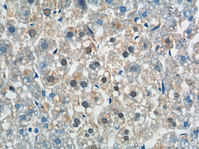 ZNF326 Antibody in Immunohistochemistry (Paraffin) (IHC (P))