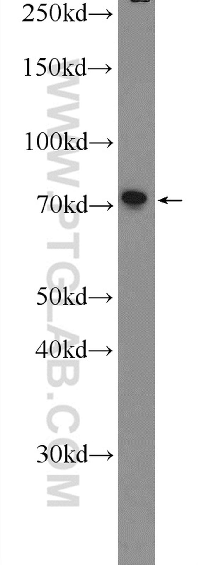 ZNF326 Antibody in Western Blot (WB)