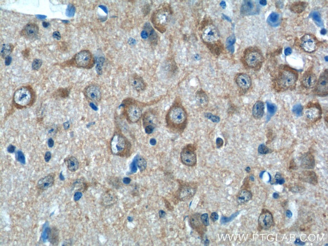 LIN7A Antibody in Immunohistochemistry (Paraffin) (IHC (P))