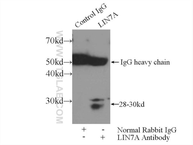 LIN7A Antibody in Immunoprecipitation (IP)