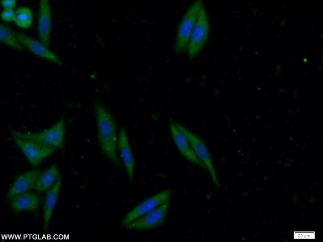 ATG2B Antibody in Immunocytochemistry (ICC/IF)