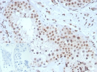 Steroidogenic Factor 1 (SF-1) (Transcription Factor) Antibody in Immunohistochemistry (Paraffin) (IHC (P))