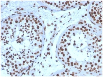 Steroidogenic Factor 1 (SF-1) Antibody in Immunohistochemistry (Paraffin) (IHC (P))