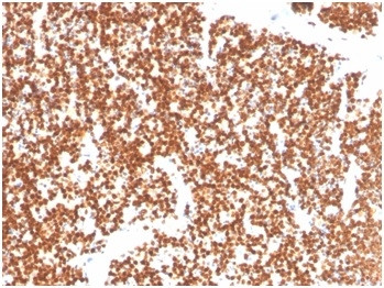 Steroidogenic Factor 1 (SF-1) Antibody in Immunohistochemistry (Paraffin) (IHC (P))