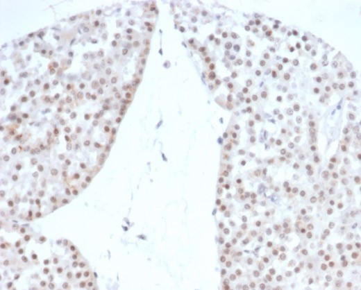 Steroidogenic Factor 1 (SF-1) Antibody in Immunohistochemistry (Paraffin) (IHC (P))