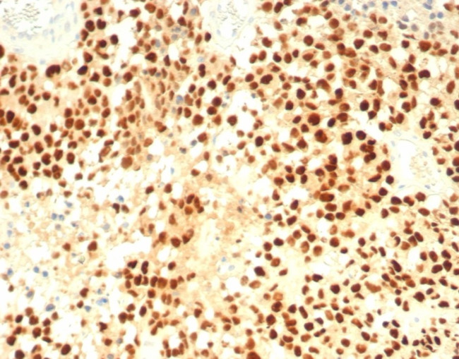 Steroidogenic Factor 1 (SF-1) Antibody in Immunohistochemistry (Paraffin) (IHC (P))