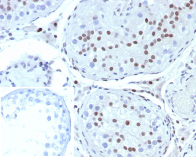 Steroidogenic Factor 1 (SF-1) Antibody in Immunohistochemistry (Paraffin) (IHC (P))