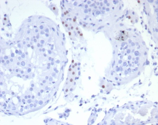 Steroidogenic Factor 1 (SF-1) Antibody in Immunohistochemistry (Paraffin) (IHC (P))