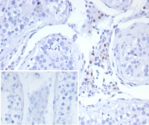 Steroidogenic Factor 1 (SF-1) Antibody in Immunohistochemistry (Paraffin) (IHC (P))