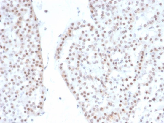 Steroidogenic Factor 1 (SF-1) Antibody in Immunohistochemistry (Paraffin) (IHC (P))