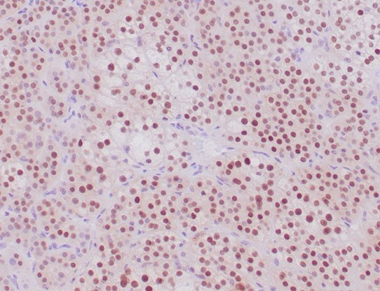 Steroidogenic Factor 1 (SF-1) Antibody in Immunohistochemistry (Paraffin) (IHC (P))