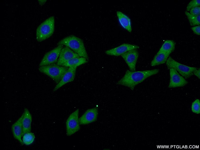 ALDH1A3 Antibody in Immunocytochemistry (ICC/IF)