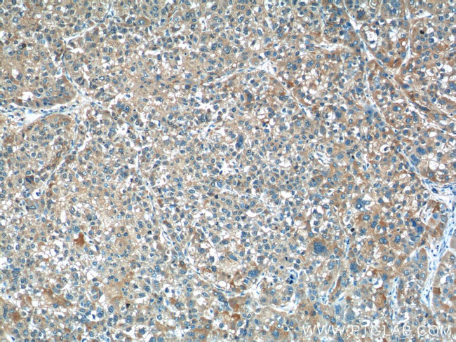 ALDH1A3 Antibody in Immunohistochemistry (Paraffin) (IHC (P))